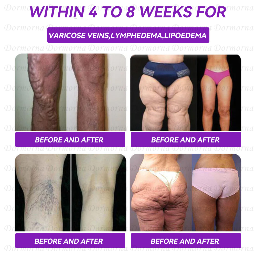 Only 6 bottles left! 🔥 Get an extra 50% off – today’s the last day! Don’t miss this perfect opportunity to transform your body! If you miss it, you’ll have to wait another year!