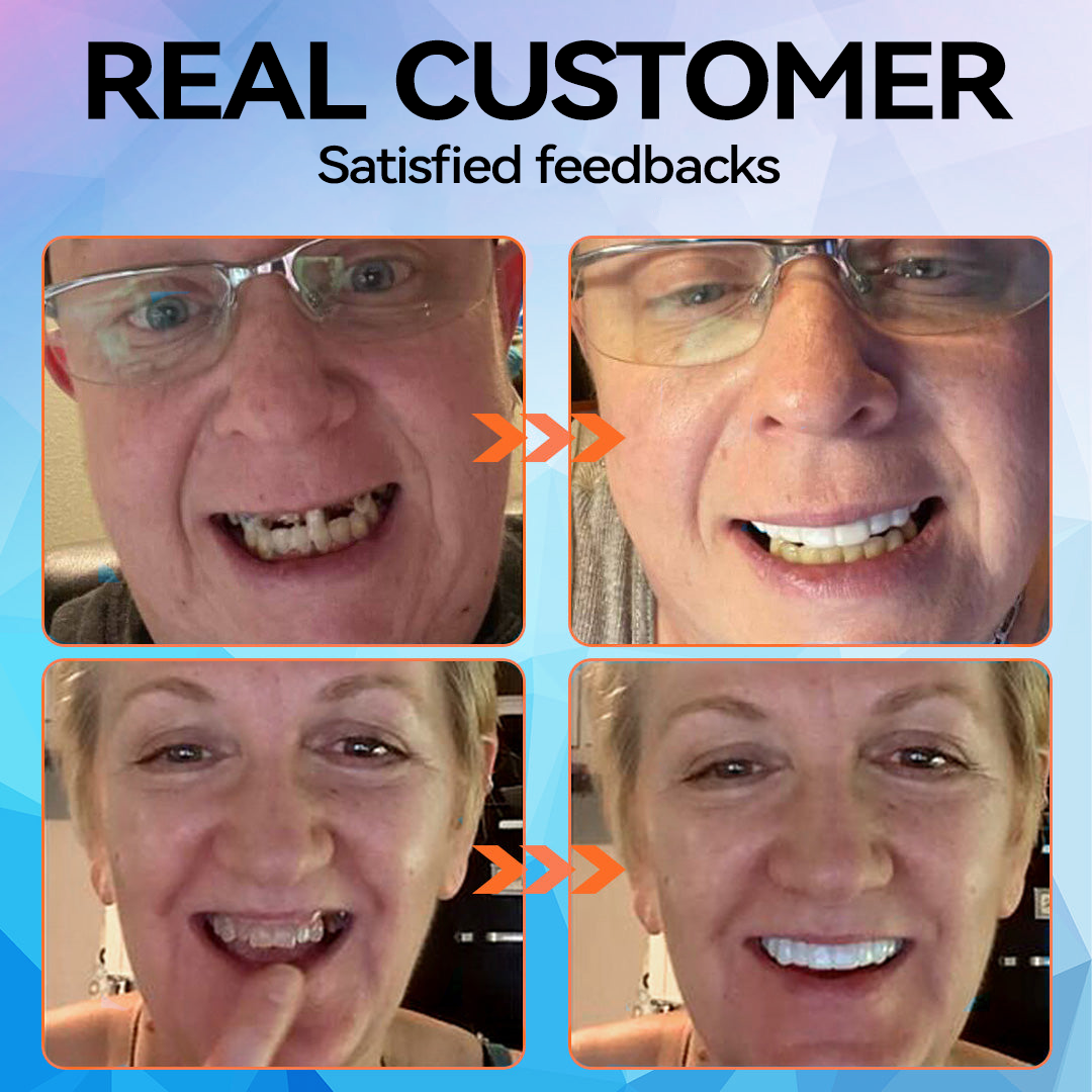 ๐๐ข๐ค๐๐ง๐๐โข๐ Silicone Reline Denture Set (โฐ Limited Time Discount Last 30 Minutes โฐ)