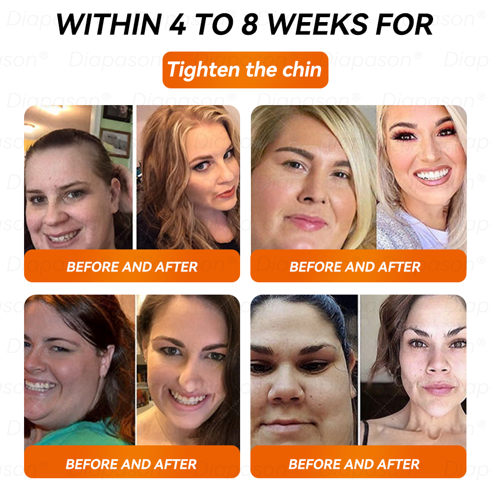 𝐷𝑖𝑎𝑝𝑎𝑠𝑜𝑛® 𝑁𝐴𝐷+ 𝐺𝐿𝑃-1 Slimming Drops 💧 - Suitable for Obesity, Diabetes, and Cardiovascular Conditions