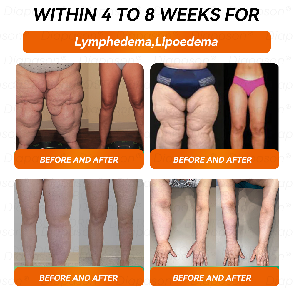 𝐷𝑖𝑎𝑝𝑎𝑠𝑜𝑛® 𝑁𝐴𝐷+ 𝐺𝐿𝑃-1 Slimming Drops 💧 - Suitable for Obesity, Diabetes, and Cardiovascular Conditions