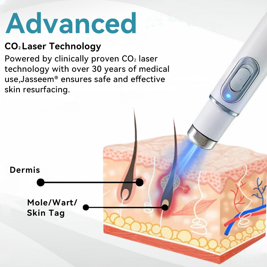 𝐉𝐚𝐬𝐬𝐞𝐞𝐦® Medical-Grade Laser Pen 💕 (Powered by CO₂ laser technology – effectively removes moles, warts, skin tags, pigmentation marks, and other skin imperfections)🏆